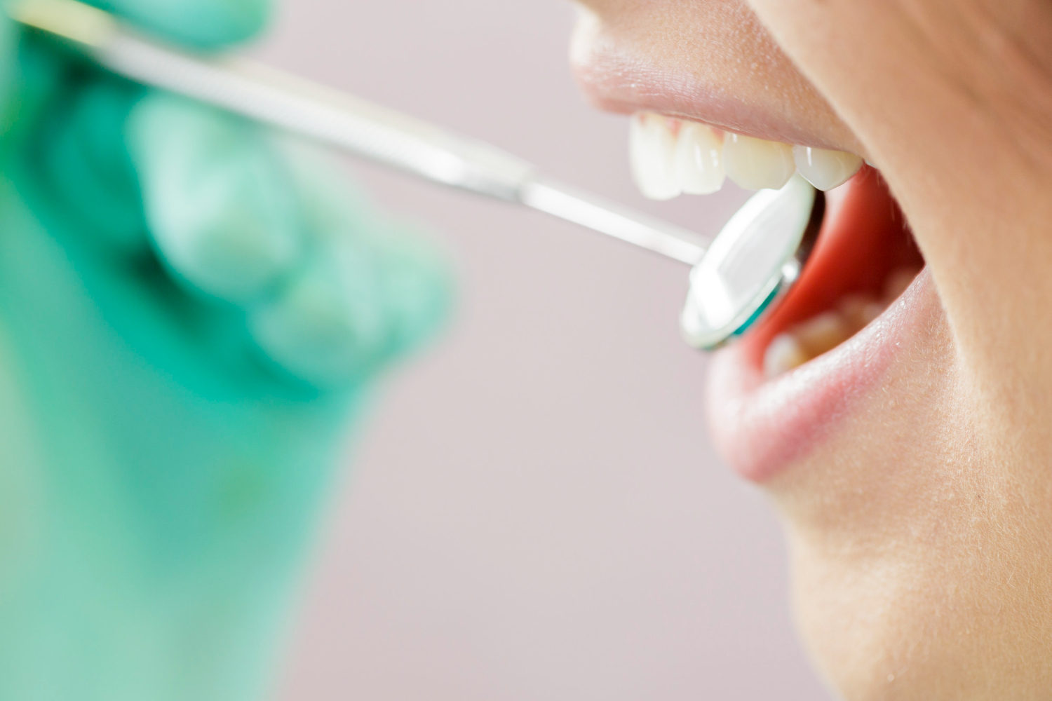 Czy paradontozą można się zarazić? 2