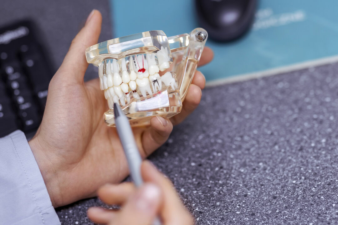 Korony i mosty zębowe <span>Szczecin</span> 1